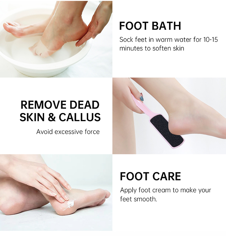 Lameila Pedicure Beauty Care Feet Grindstone Callus Remover Product Single Plastic Hand Dead Skin File Tools Foot File C0355
