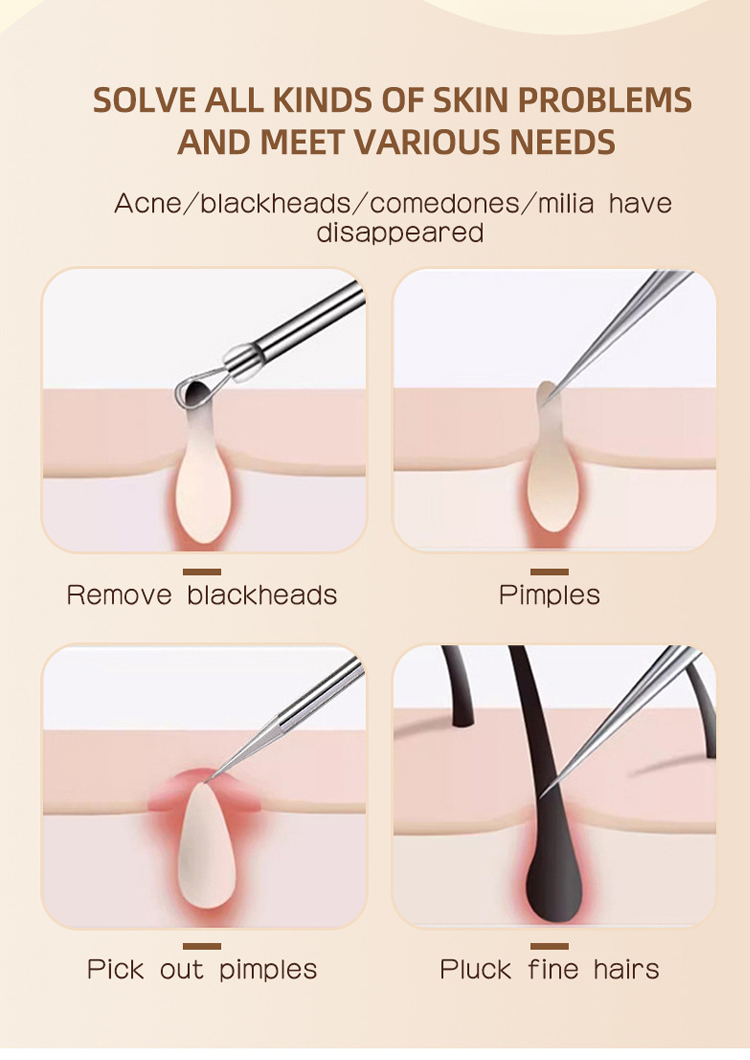 Professional Facial Pore Cleaner Acne Removal Kit Stainless Steel Facial Nose Pimple Extractor Tool Blackhead Remover ToolsUS06 US09