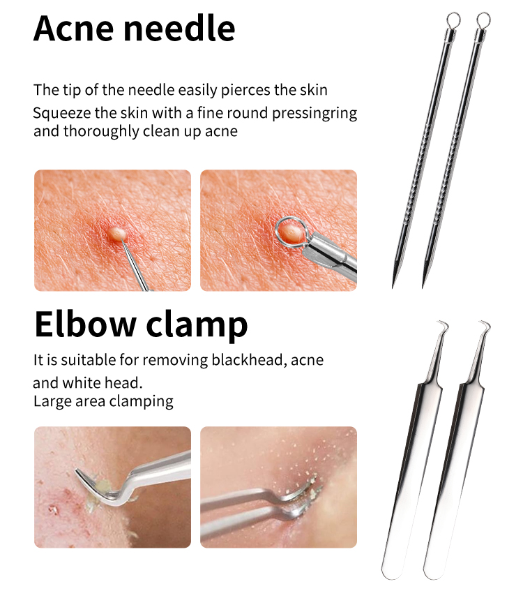 Stainless Steel Blackhead Needle JJF19 Tweezers 2 Pcs/Set Pimple Removal Tweezer Facial Care Tool Kit for Nose Acne Treatment