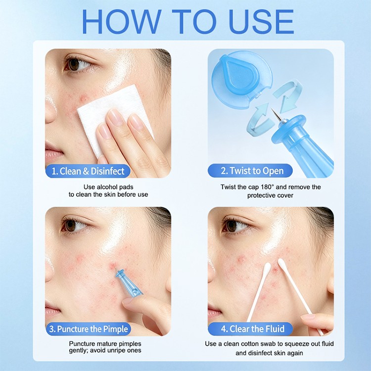 LMLTOP Portable Stainless Steel Acne Needle Blackhead Comedone Extractor Tool Remove Pimple Whitehead for Daily Facial Care Y029