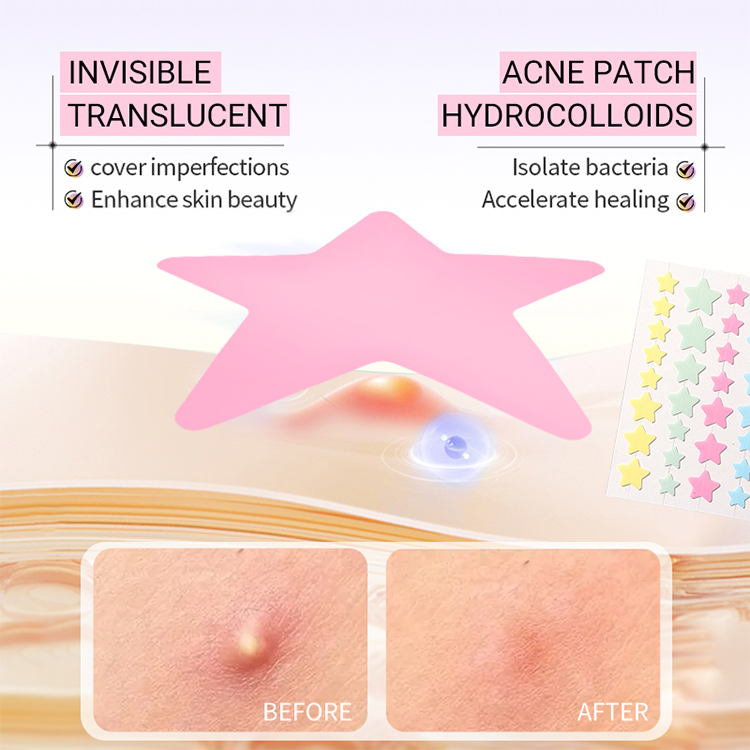 New Hydrocolloid Salicylic Acid Acne Pimple Patch Facial Acne Treatment Dots for Invisible Breathable Vegan Patch For Korean Y026
