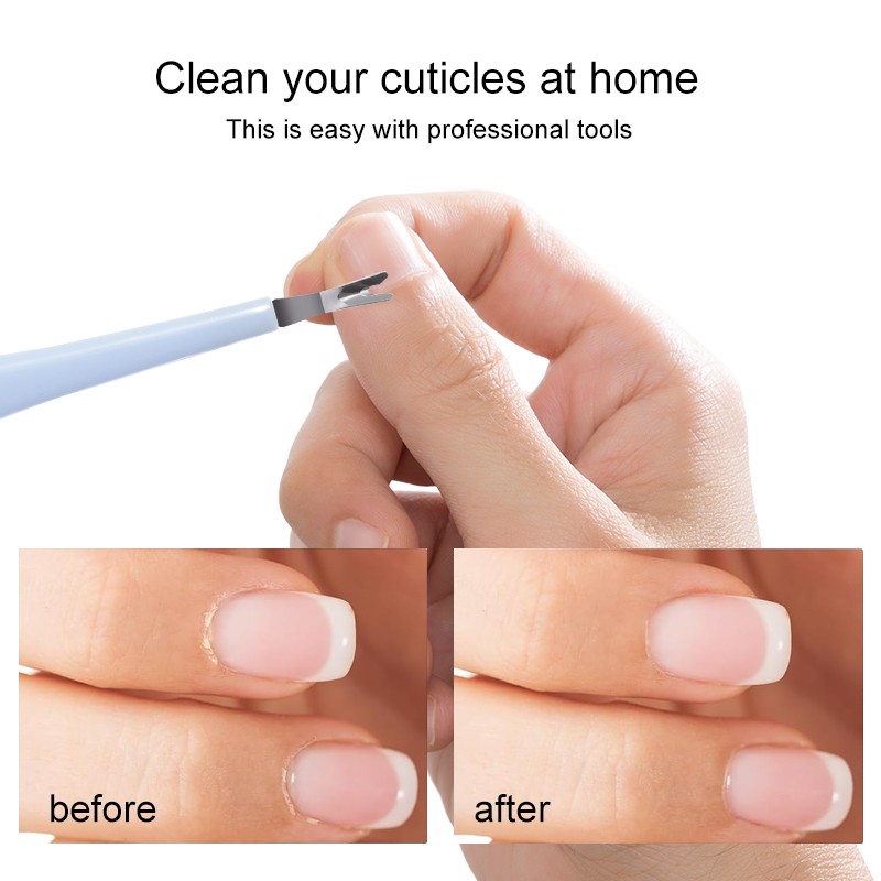 Lameila Stainless Steel Cuticle Nail Pusher Dead Skin Push Pedicure Manicure Tools Plastic Nail Cuticle Pusher 3130 Lameila Stainless Steel Cuticle Nail Pusher Dead Skin Push Pedicure Manicure Tools Plastic Nail Cuticle Pusher 3130